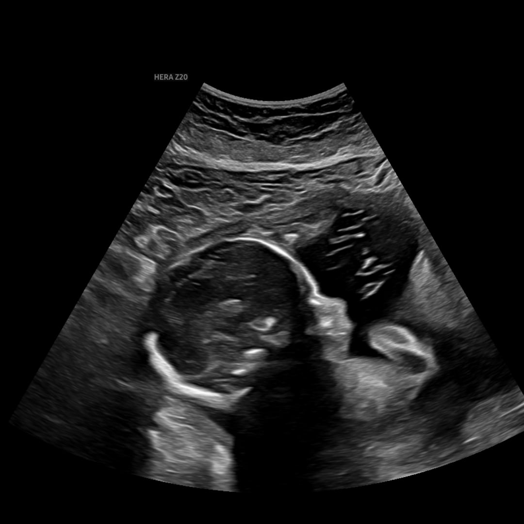 Photo shared by Charity for their Babylist baby registry.