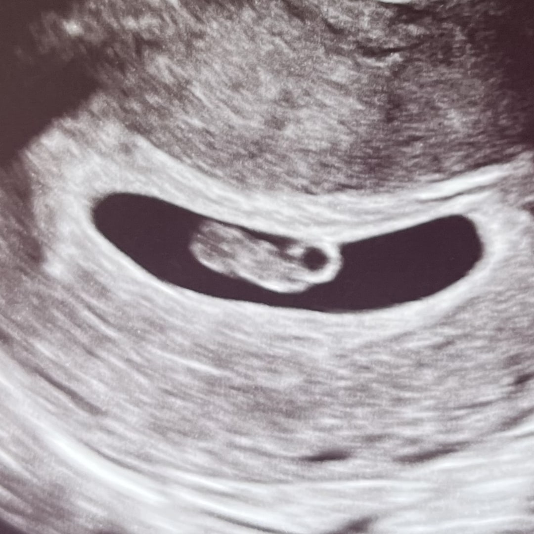 Photo shared by Amanda for their Babylist baby registry.