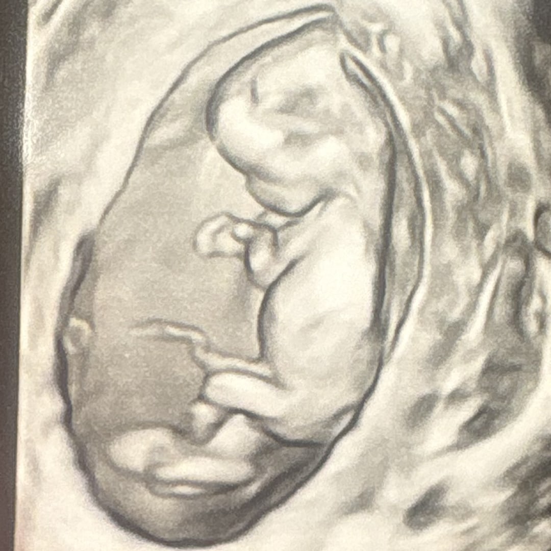Photo shared by Brianna for their Babylist baby registry.
