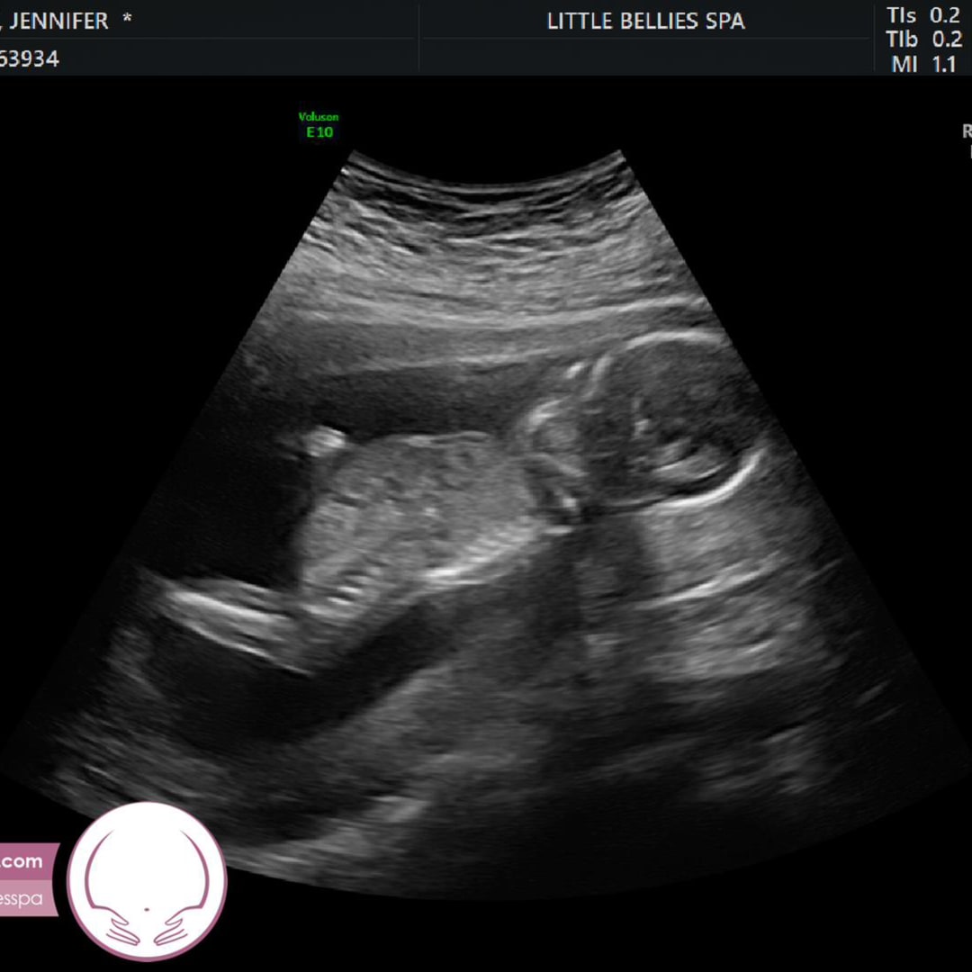 Photo shared by Jennifer for their Babylist baby registry.