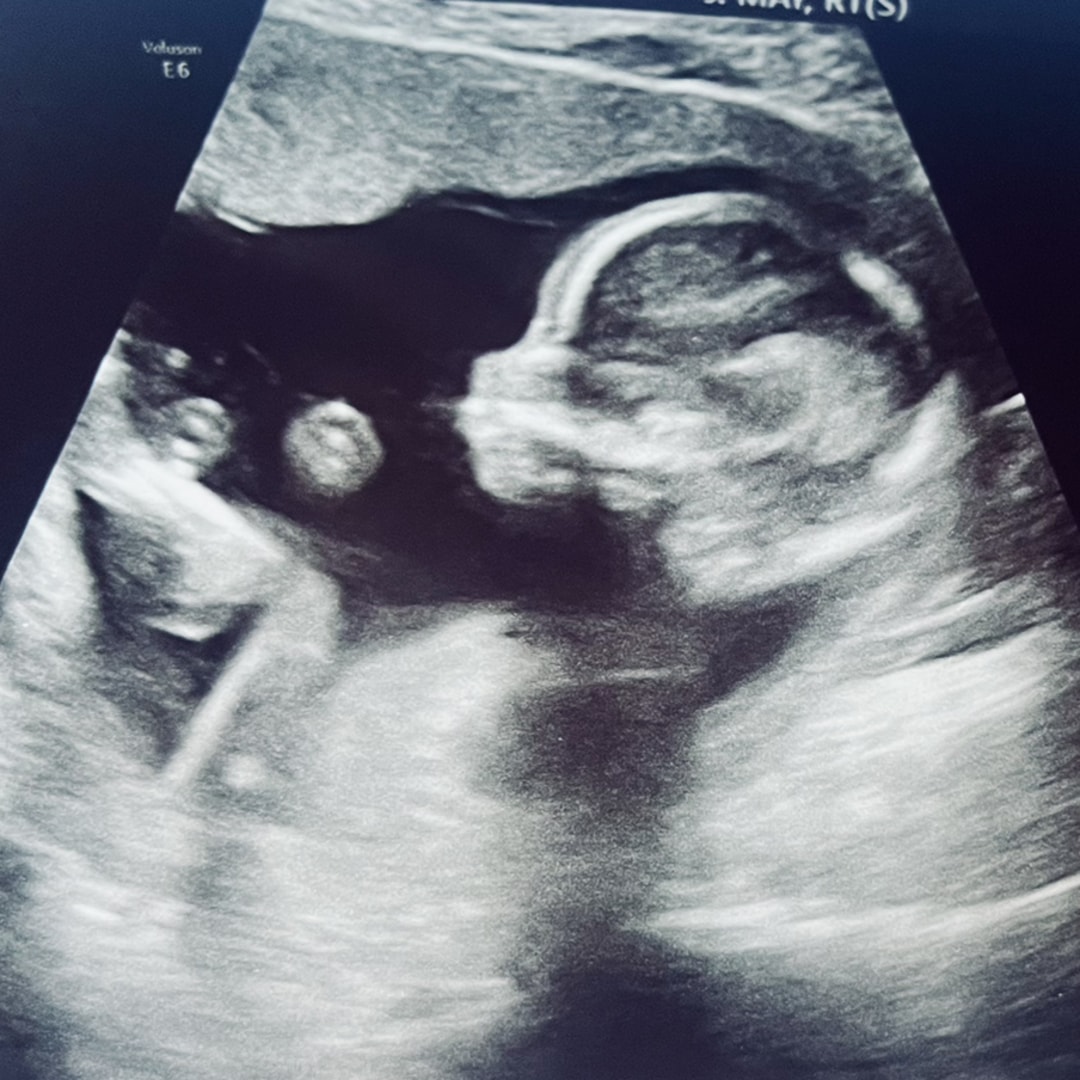 Photo shared by Carol Ann for their Babylist baby registry.