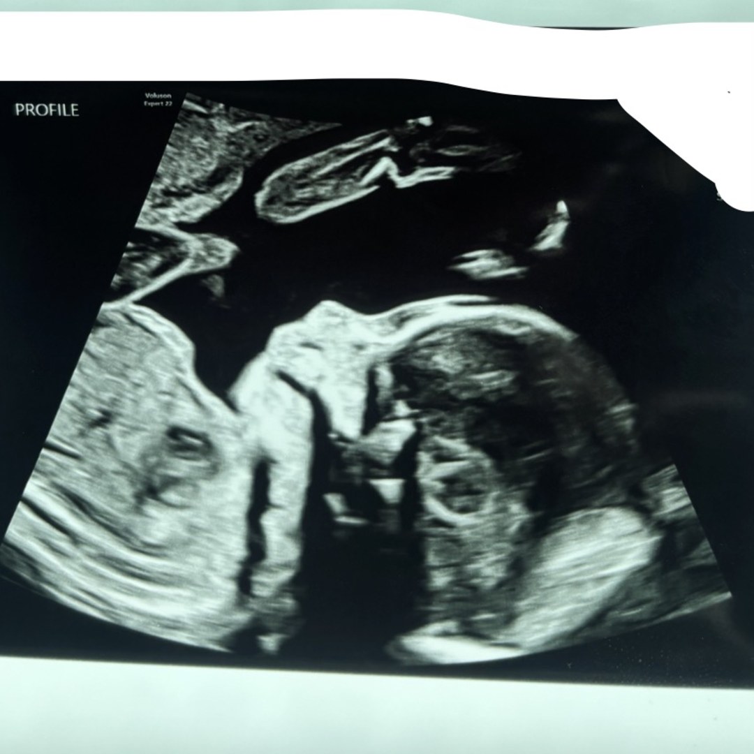 Photo shared by Ashley for their Babylist baby registry.