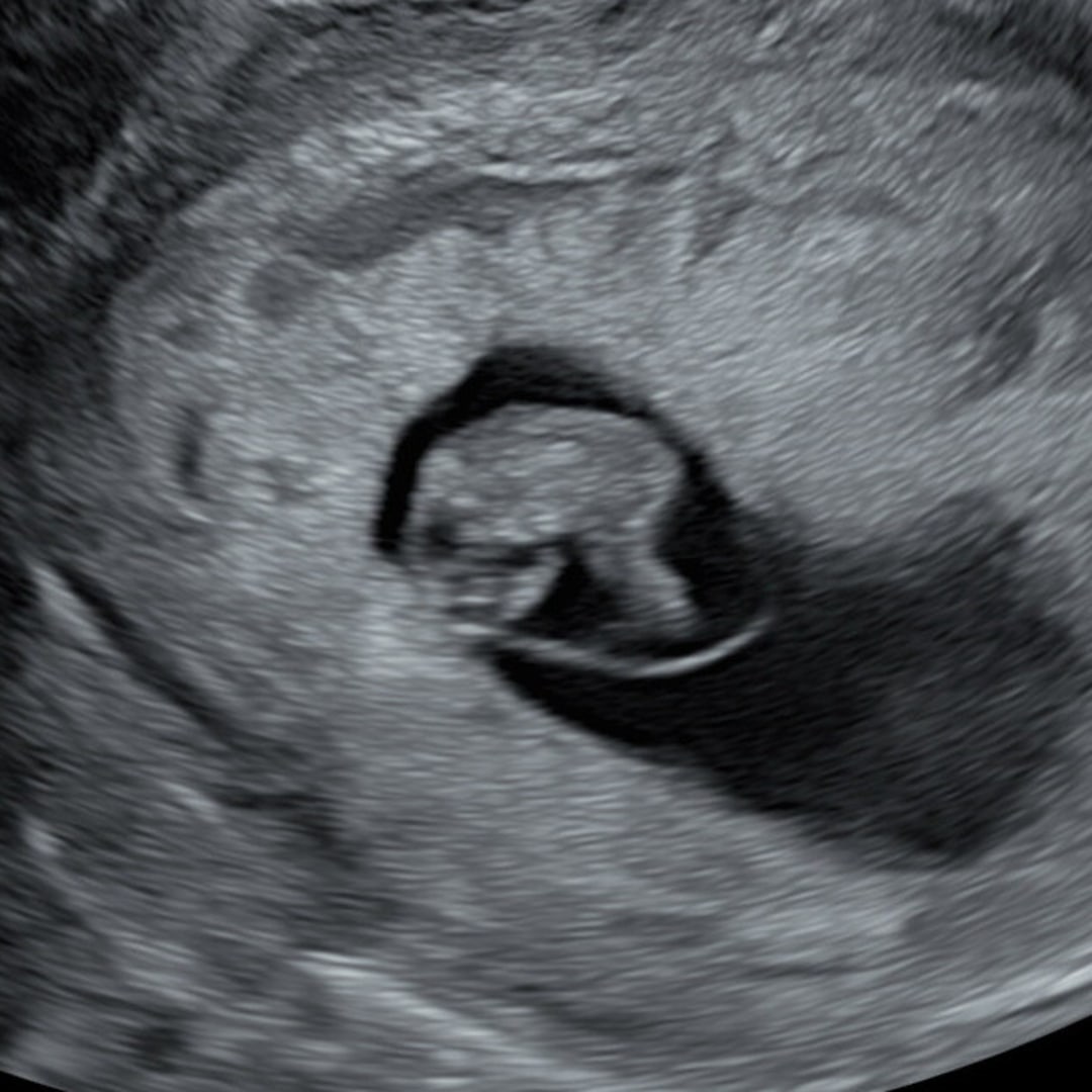 Photo shared by Chelsea for their Babylist baby registry.