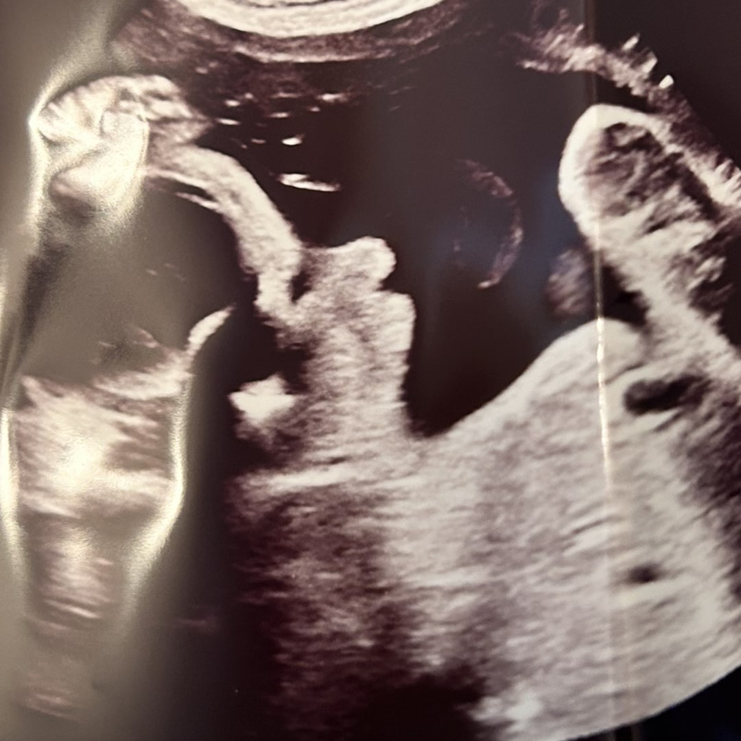 Photo shared by Olivia for their Babylist baby registry.