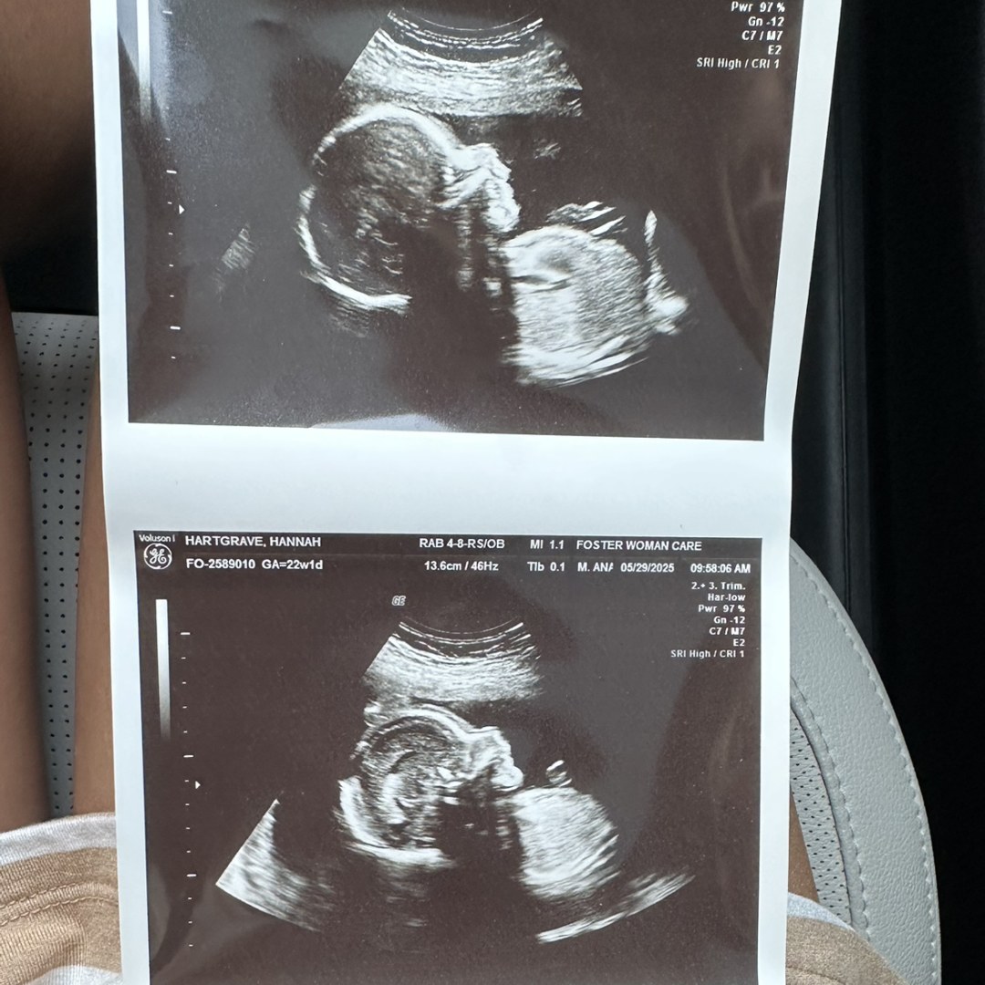 Photo shared by Hannah for their Babylist baby registry.