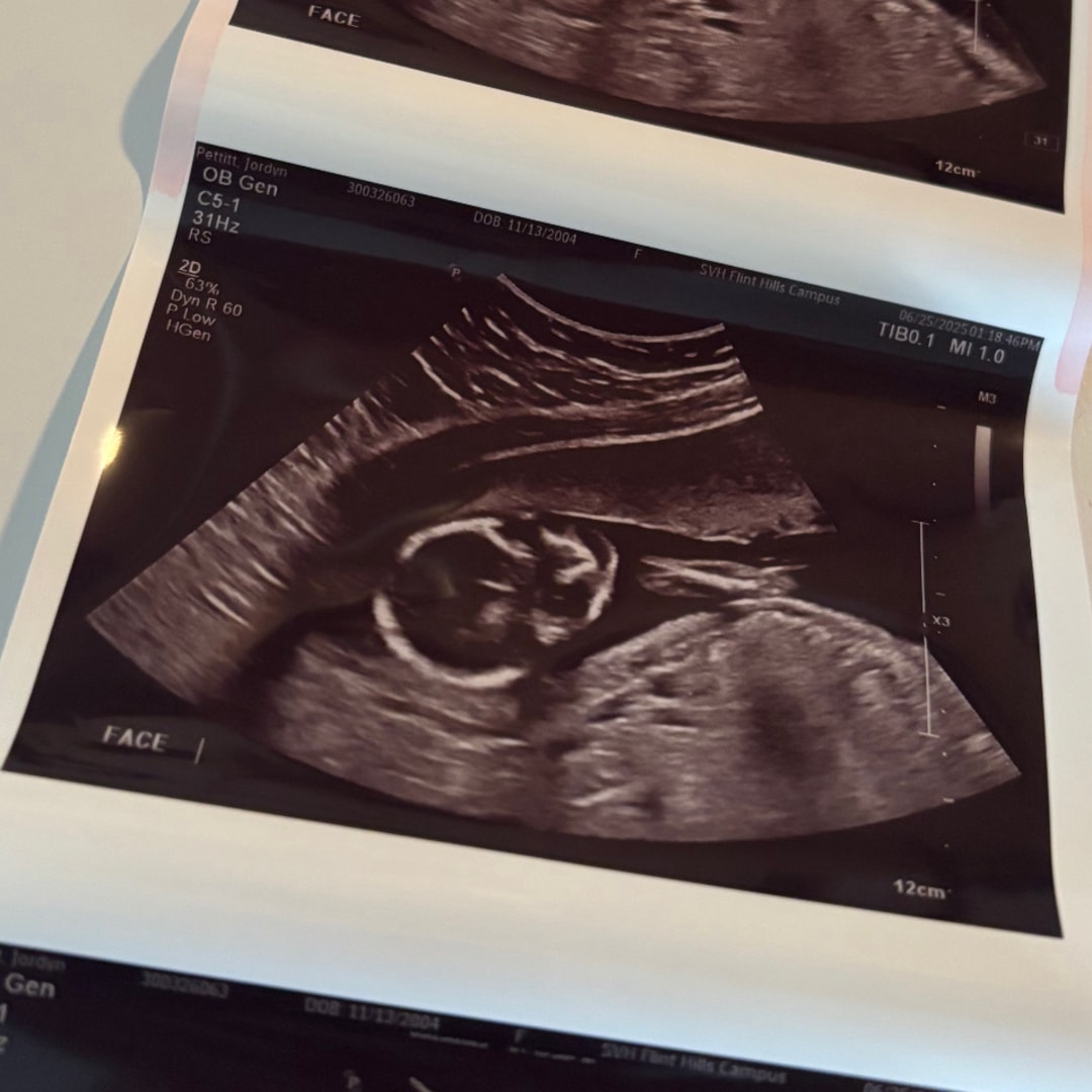 Photo shared by Jordyn for their Babylist baby registry.
