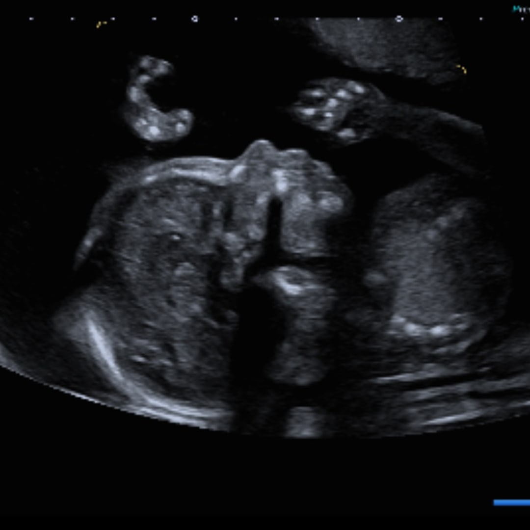 Photo shared by Kahli for their Babylist baby registry.