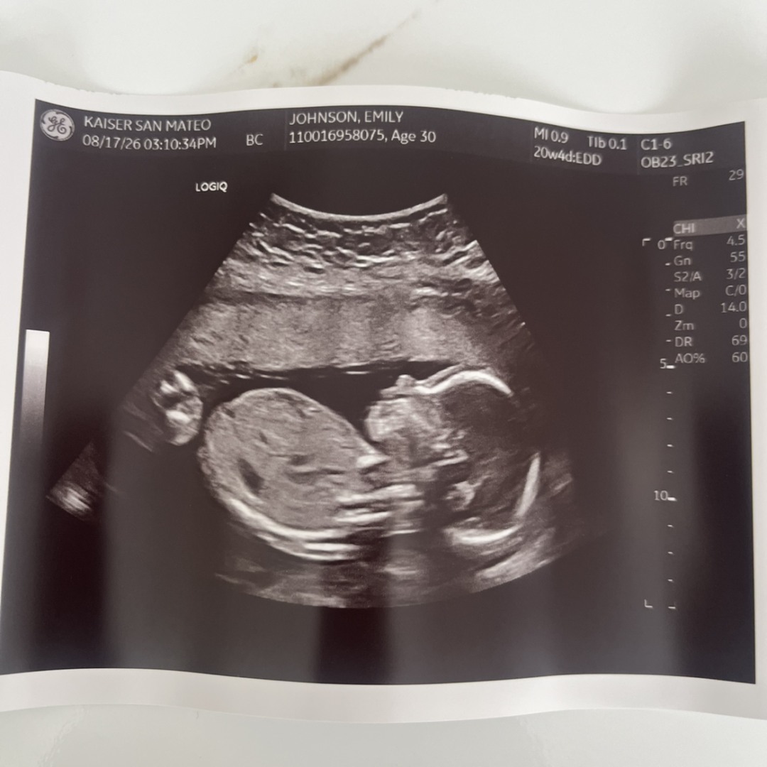 Photo shared by Emily for their Babylist baby registry.