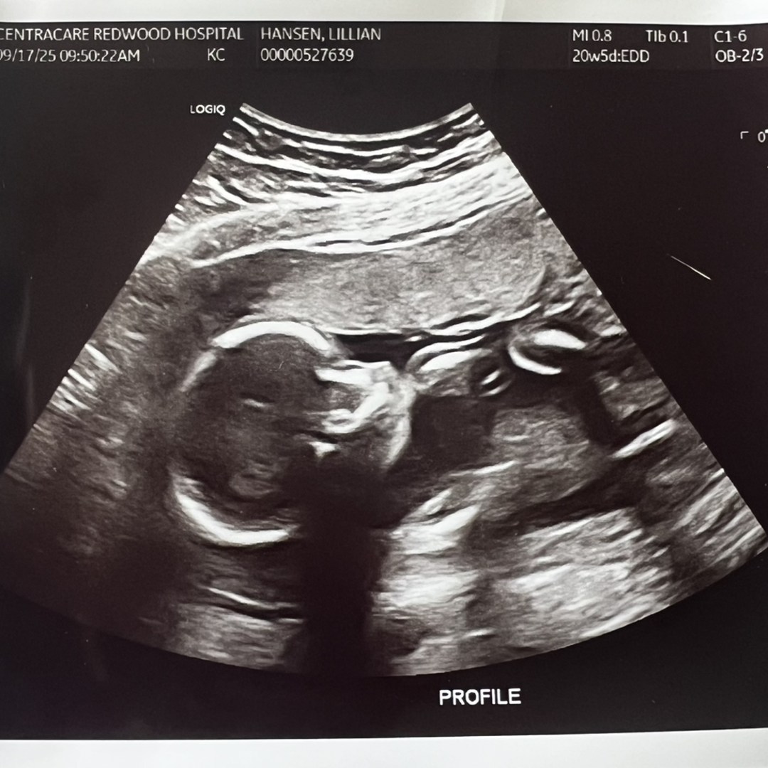 Photo shared by Lilly for their Babylist baby registry.