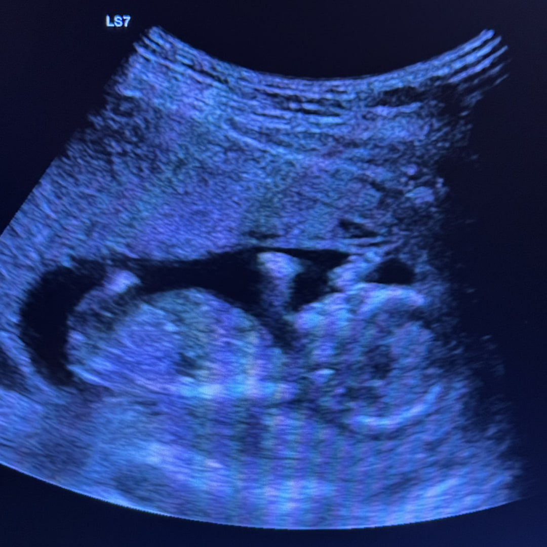 Photo shared by Rachel for their Babylist baby registry.