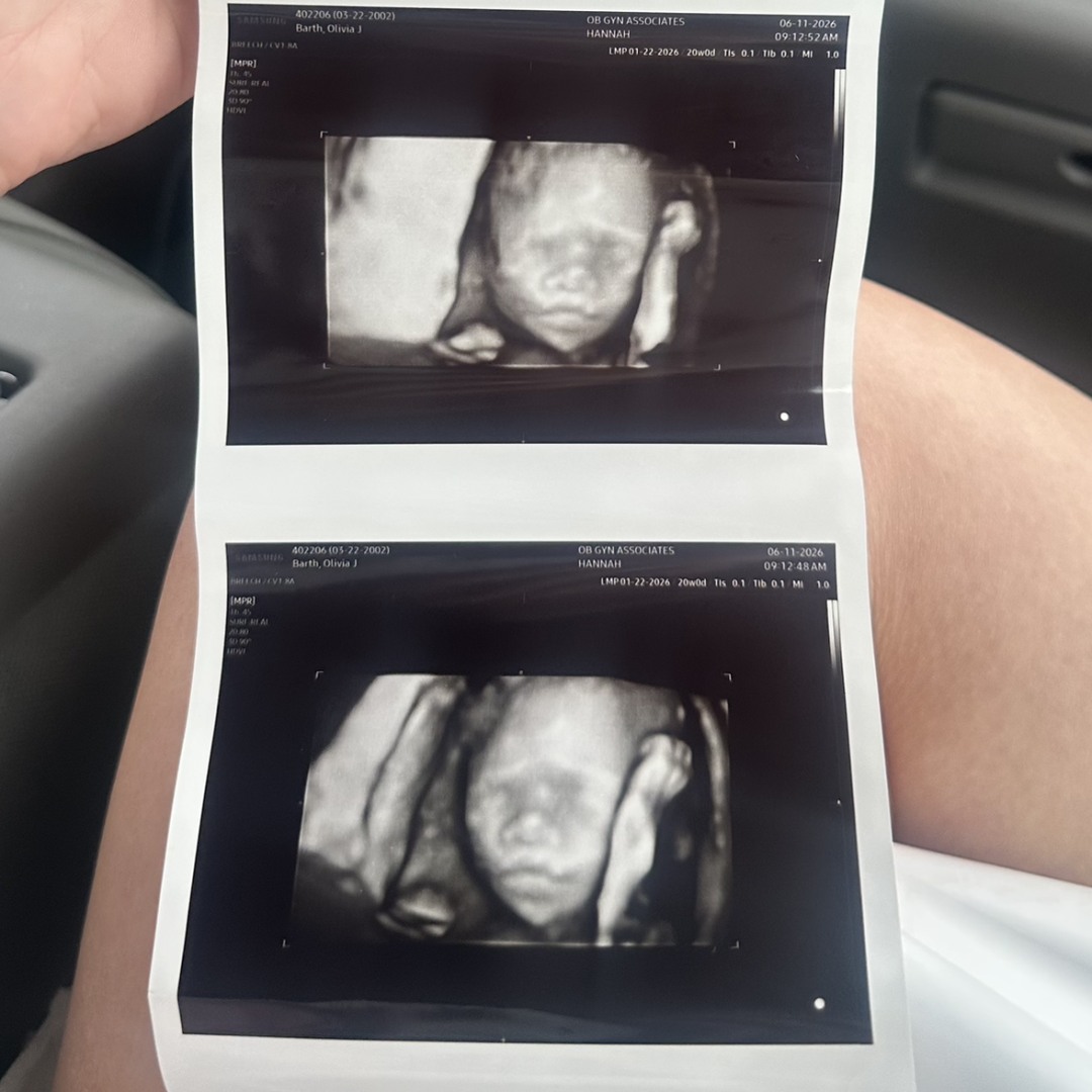 Photo shared by Olivia for their Babylist baby registry.
