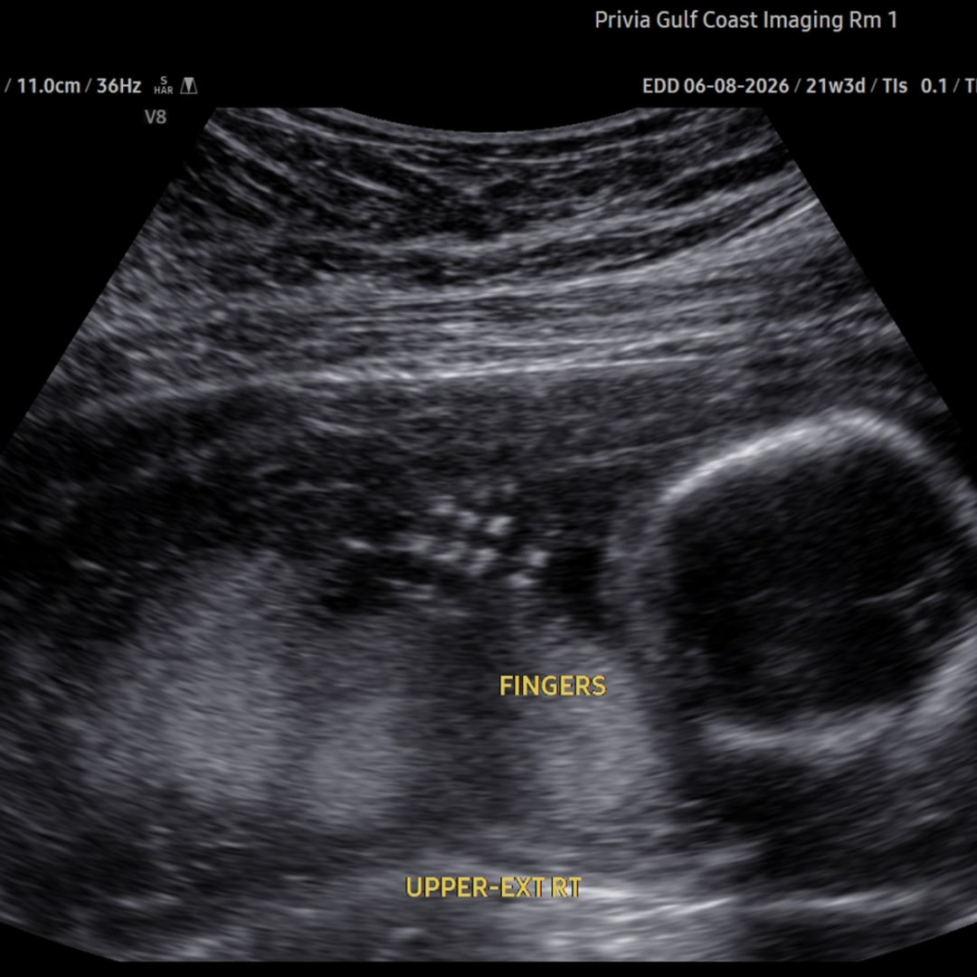 Photo shared by Lauren for their Babylist baby registry.