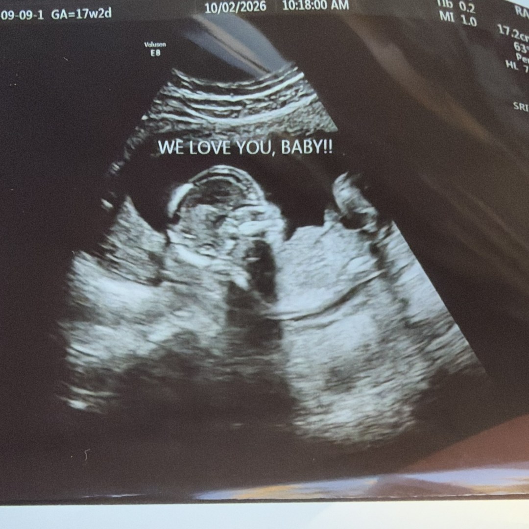 Photo shared by Grace for their Babylist baby registry.