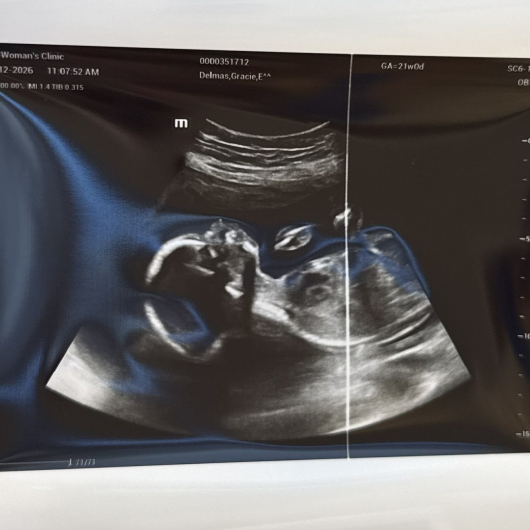 Photo shared by Gracie for their Babylist baby registry.