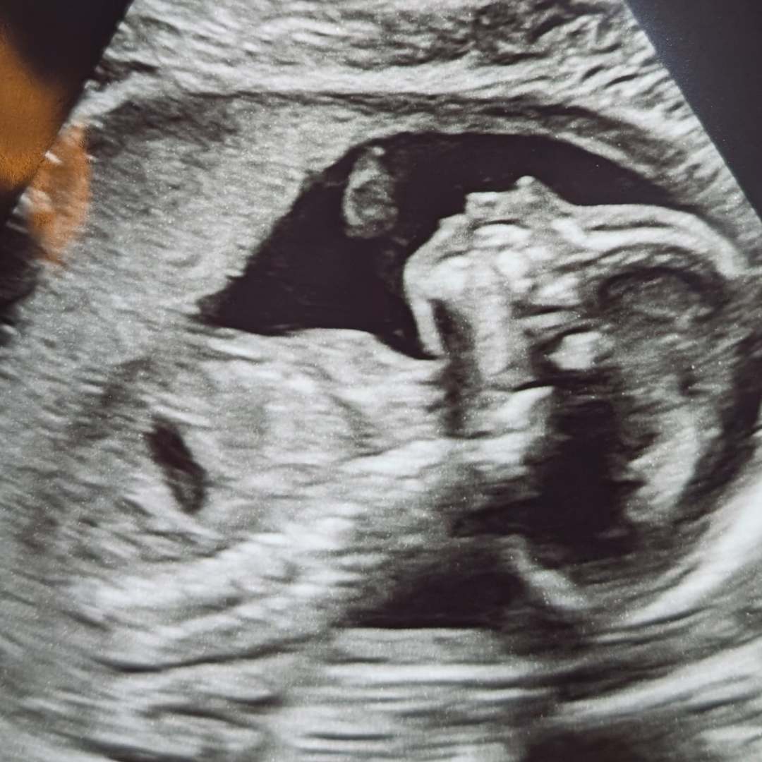 Photo shared by Caylee for their Babylist baby registry.