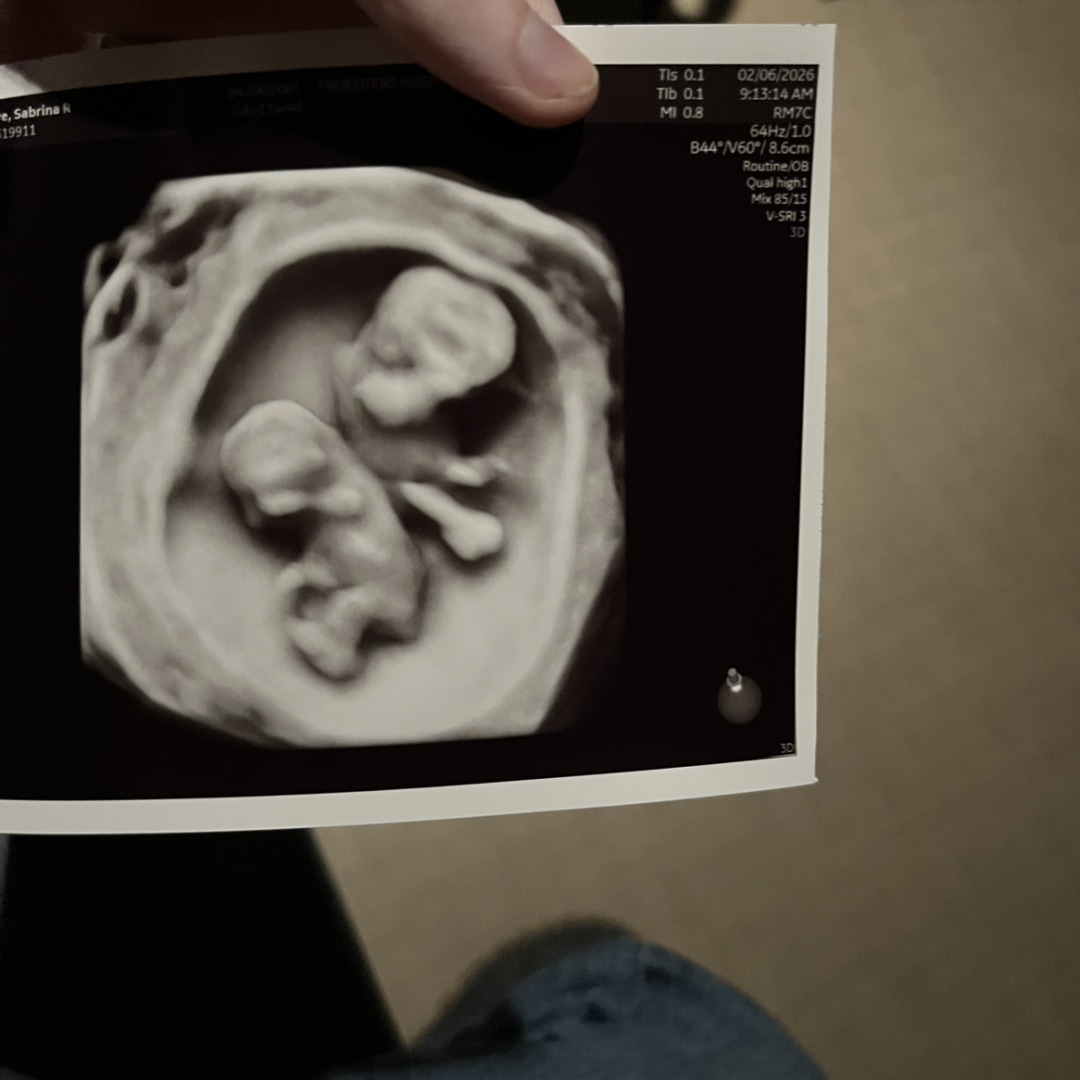 Photo shared by Vix for their Babylist baby registry.