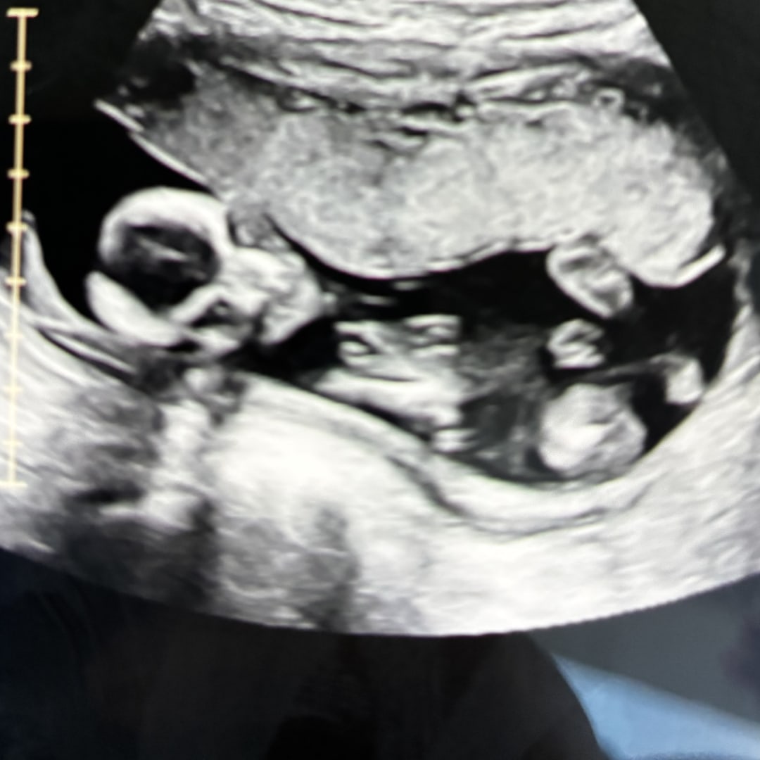 Photo shared by Destiny for their Babylist baby registry.