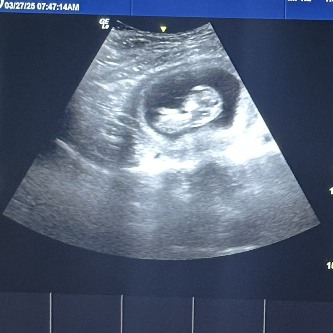 Photo shared by Aden for their Babylist baby registry.