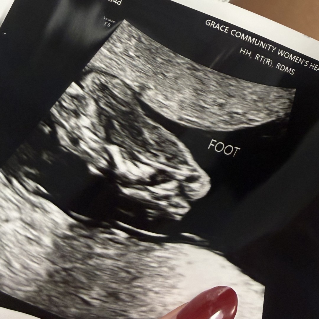 Photo shared by Lacey for their Babylist baby registry.