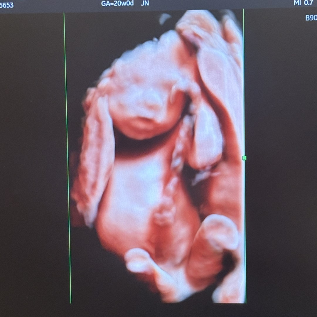 Photo shared by Vivian for their Babylist baby registry.