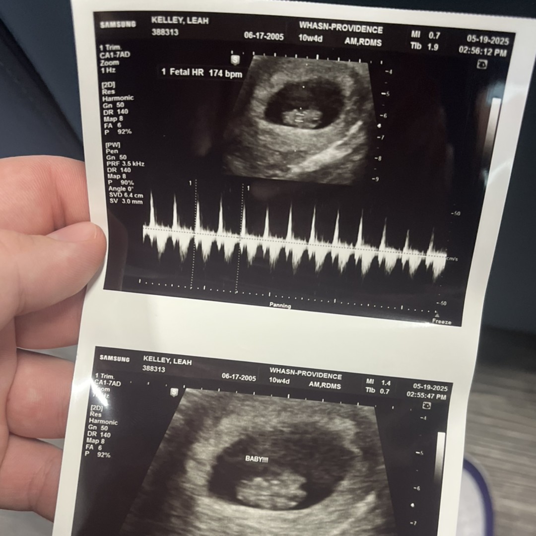 Photo shared by Aiden for their Babylist baby registry.