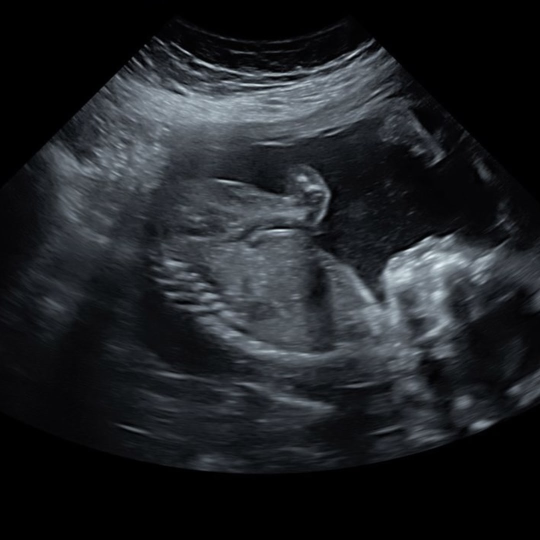Photo shared by Hailey for their Babylist baby registry.