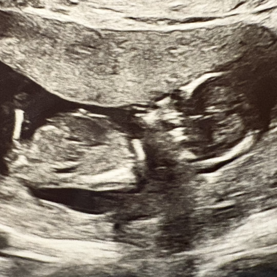 Photo shared by Shawnna for their Babylist baby registry.