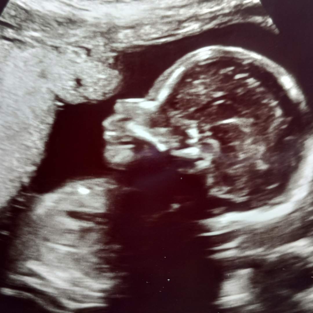 Photo shared by Melissa for their Babylist baby registry.