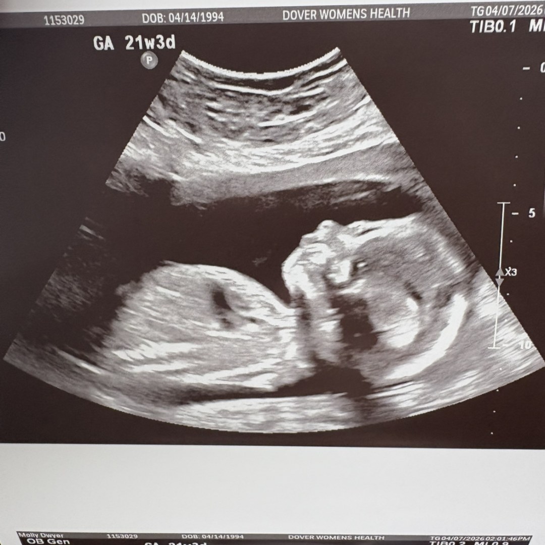 Photo shared by Molly for their Babylist baby registry.