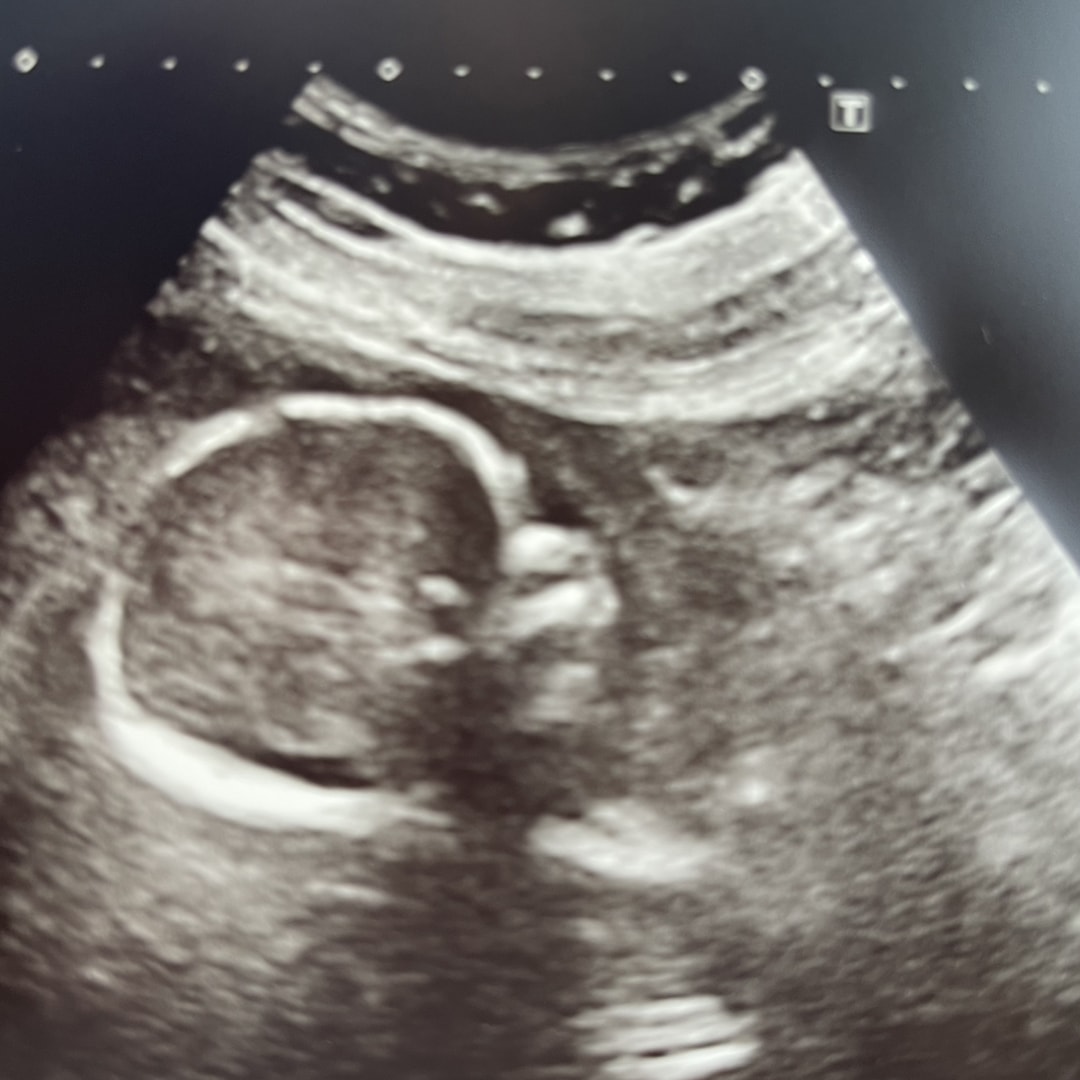 Photo shared by Laura for their Babylist baby registry.