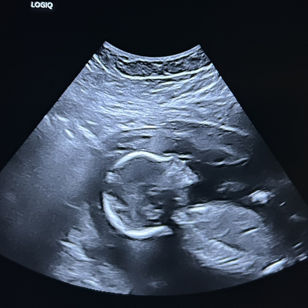 Photo shared by Dasery for their Babylist baby registry.