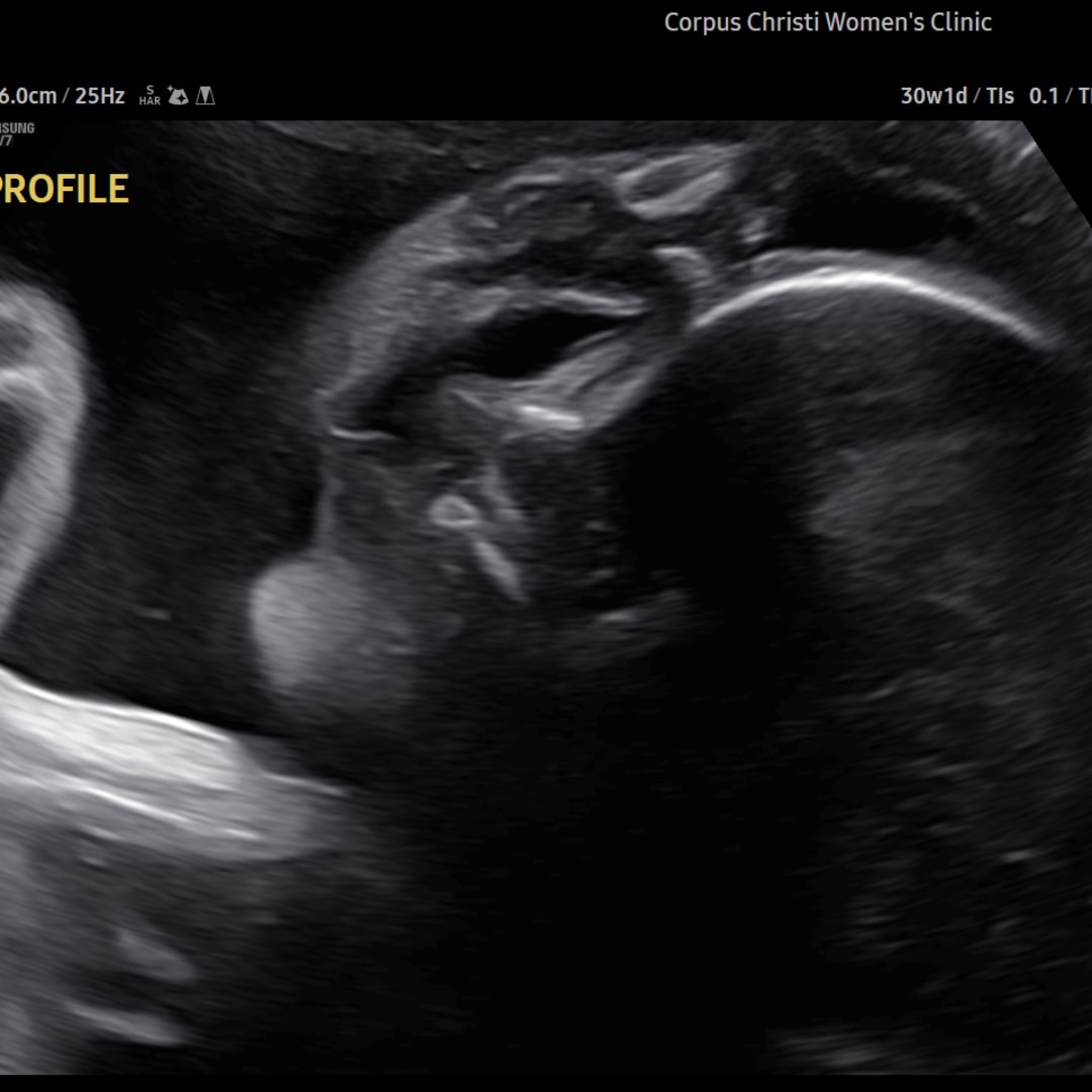 Photo shared by Alyssa for their Babylist baby registry.