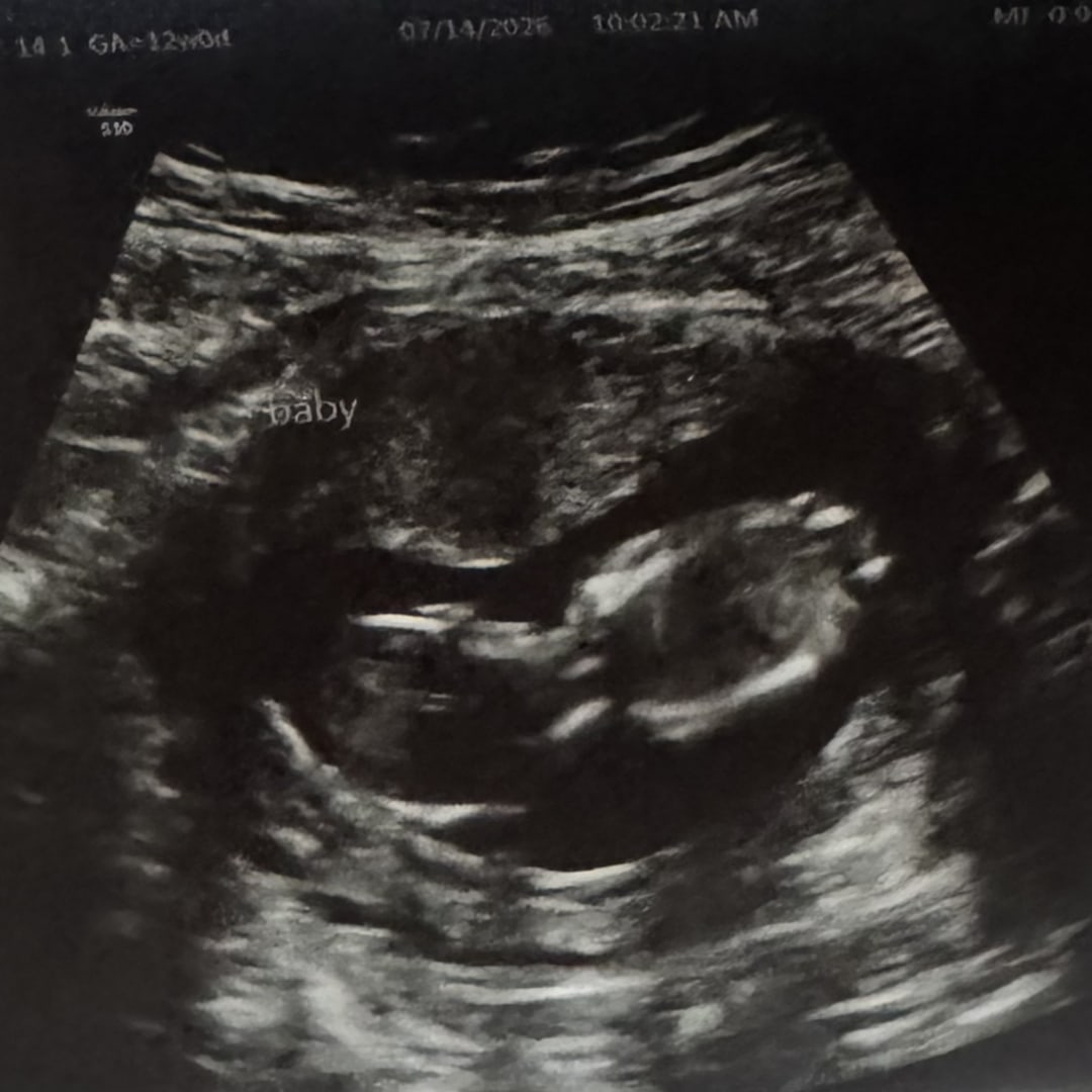 Photo shared by Karen for their Babylist baby registry.