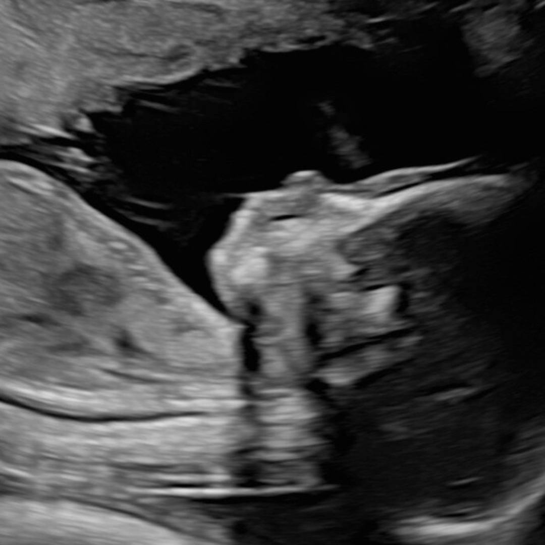 Photo shared by Rockell for their Babylist baby registry.