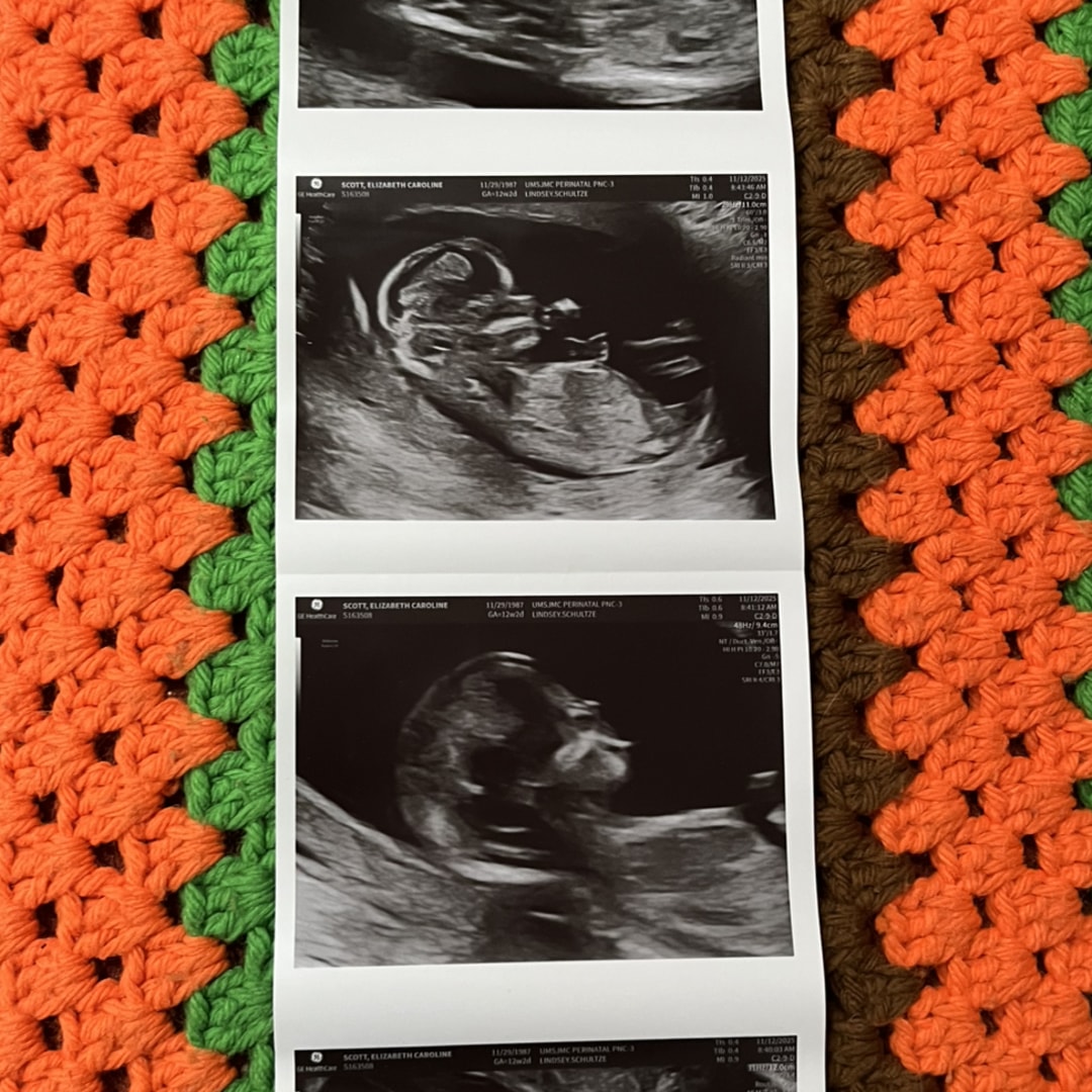 Photo shared by Betsy for their Babylist baby registry.