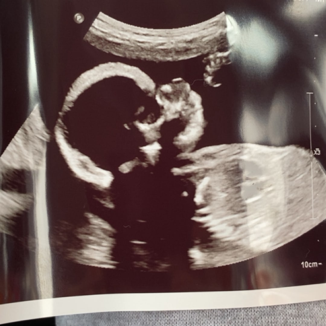 Photo shared by Krislyn for their Babylist baby registry.