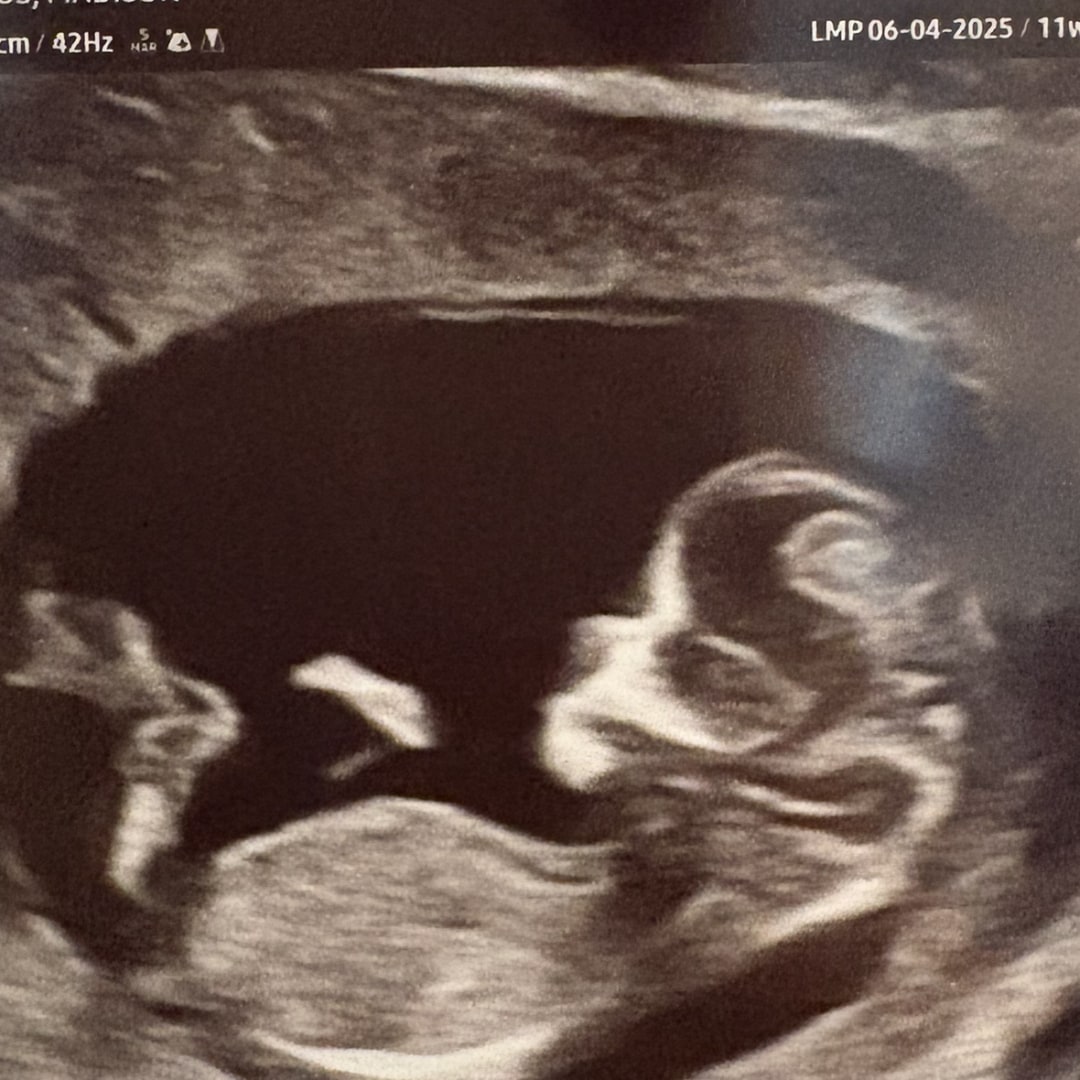 Photo shared by Madison for their Babylist baby registry.