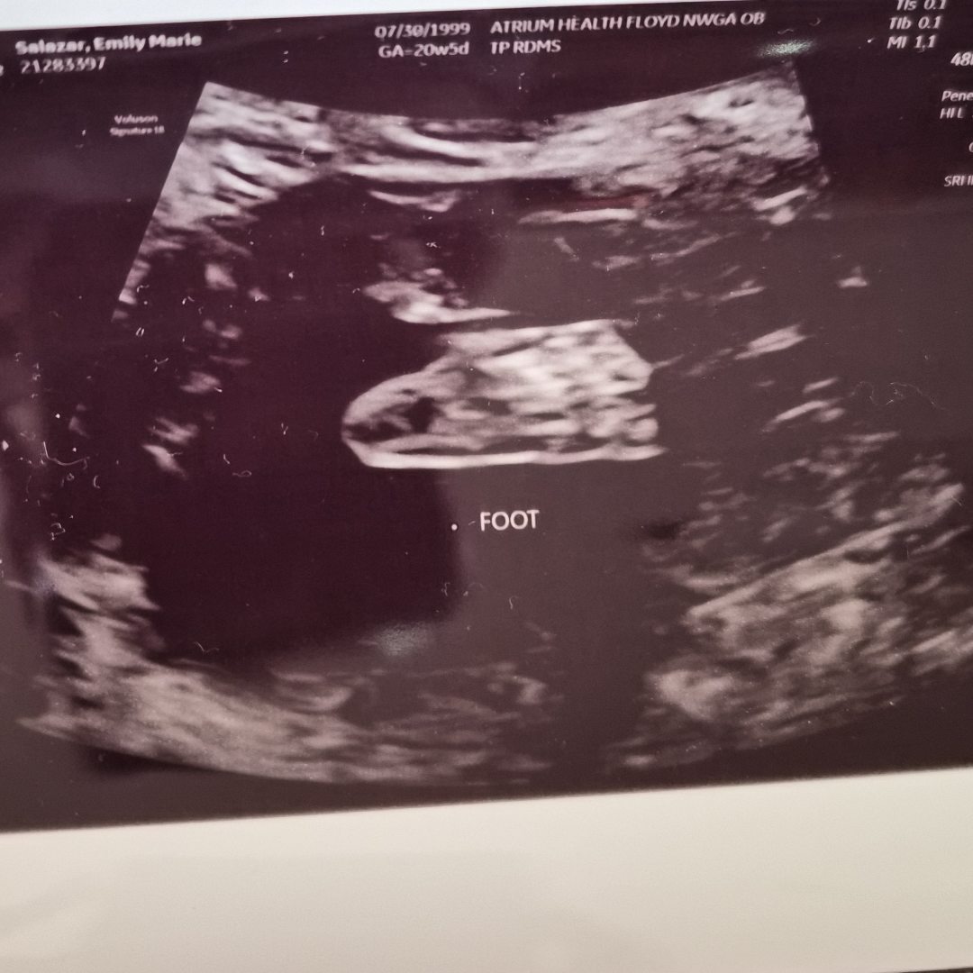 Photo shared by Emily for their Babylist baby registry.