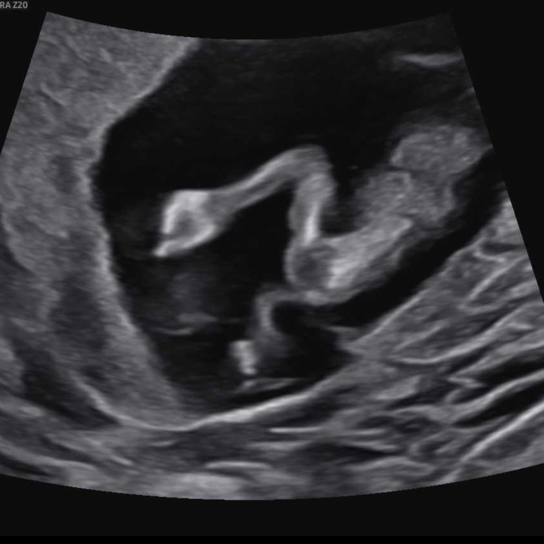 Photo shared by Paige for their Babylist baby registry.