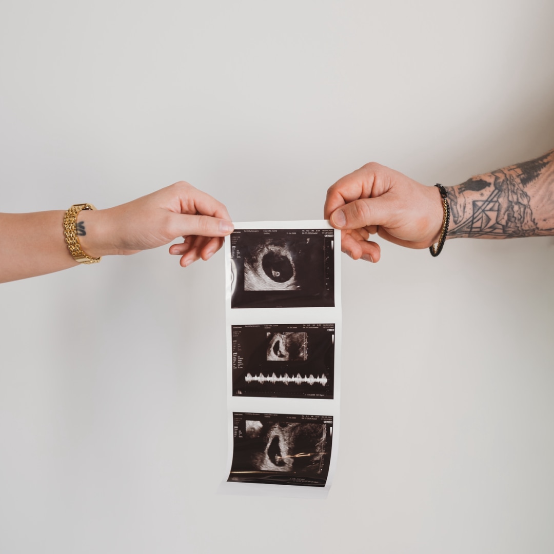 Photo shared by Carlie for their Babylist baby registry.