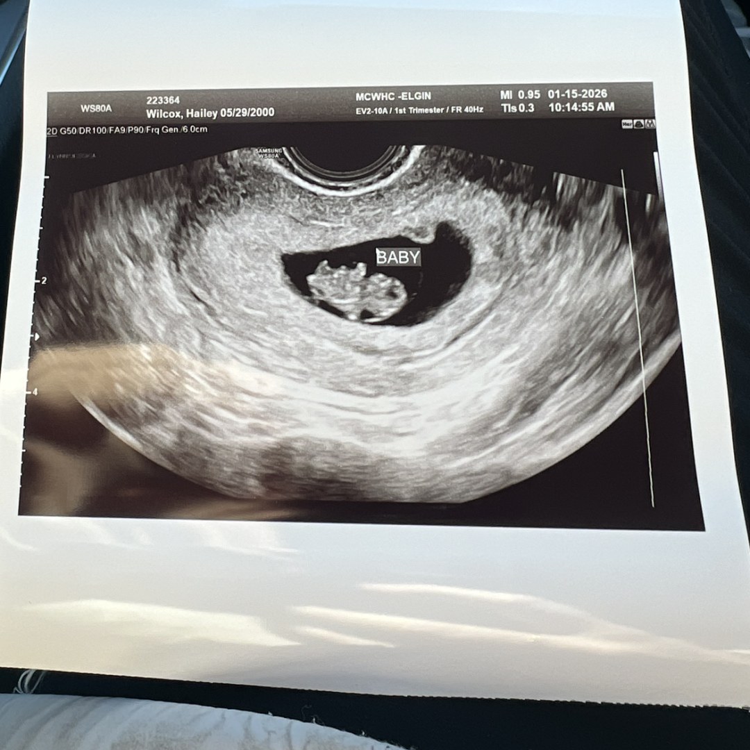 Photo shared by Hailey for their Babylist baby registry.