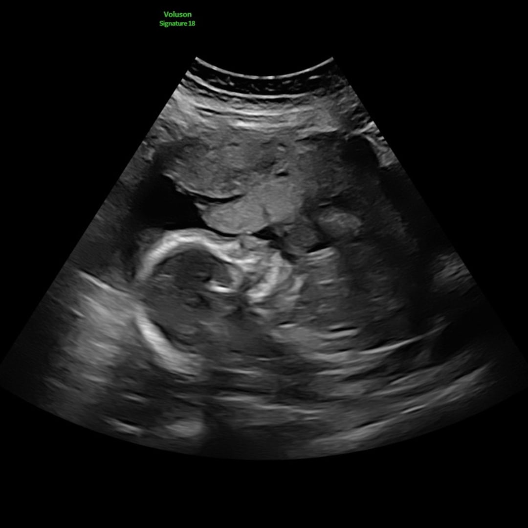 Photo shared by Lexie for their Babylist baby registry.