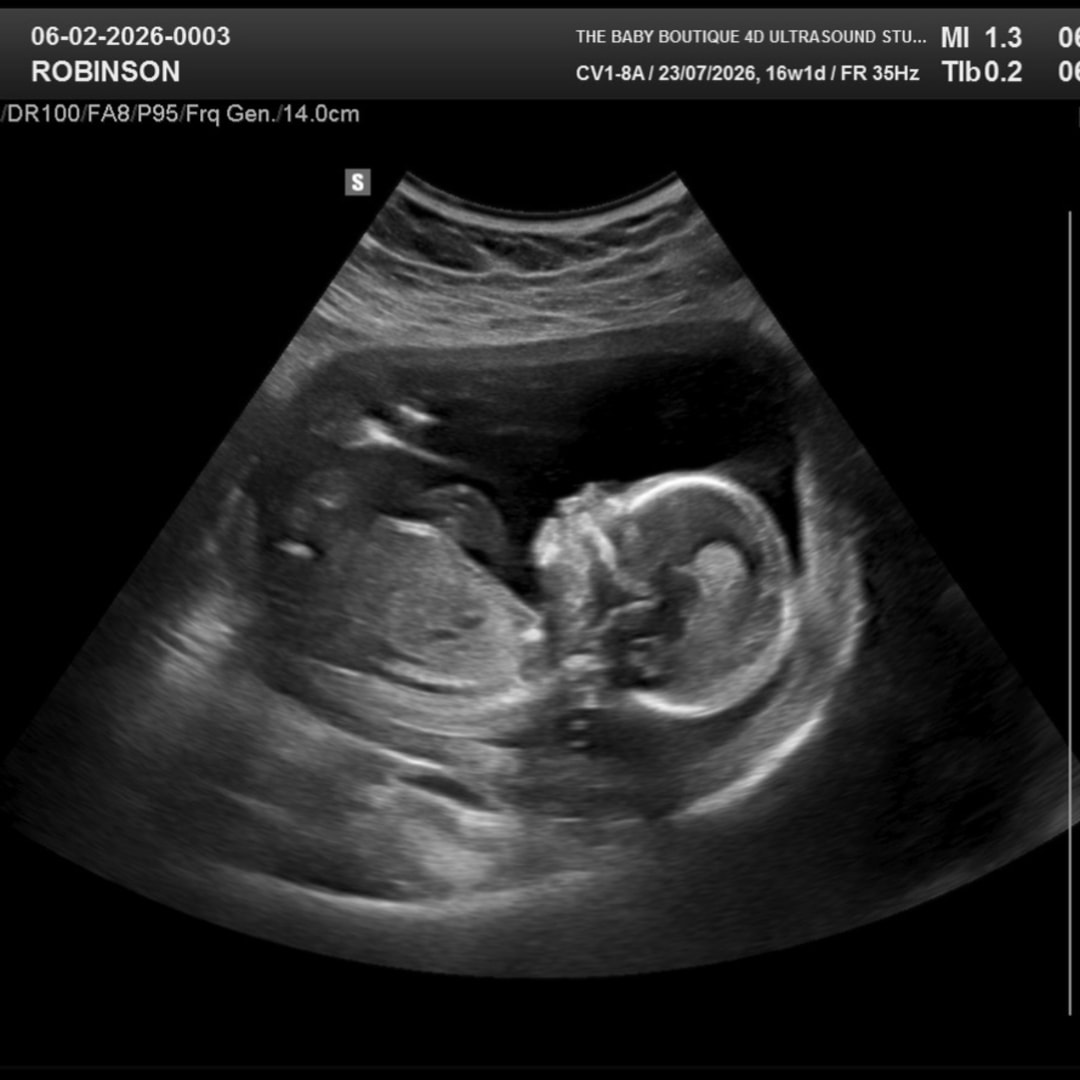 Photo shared by Caitlyn for their Babylist baby registry.