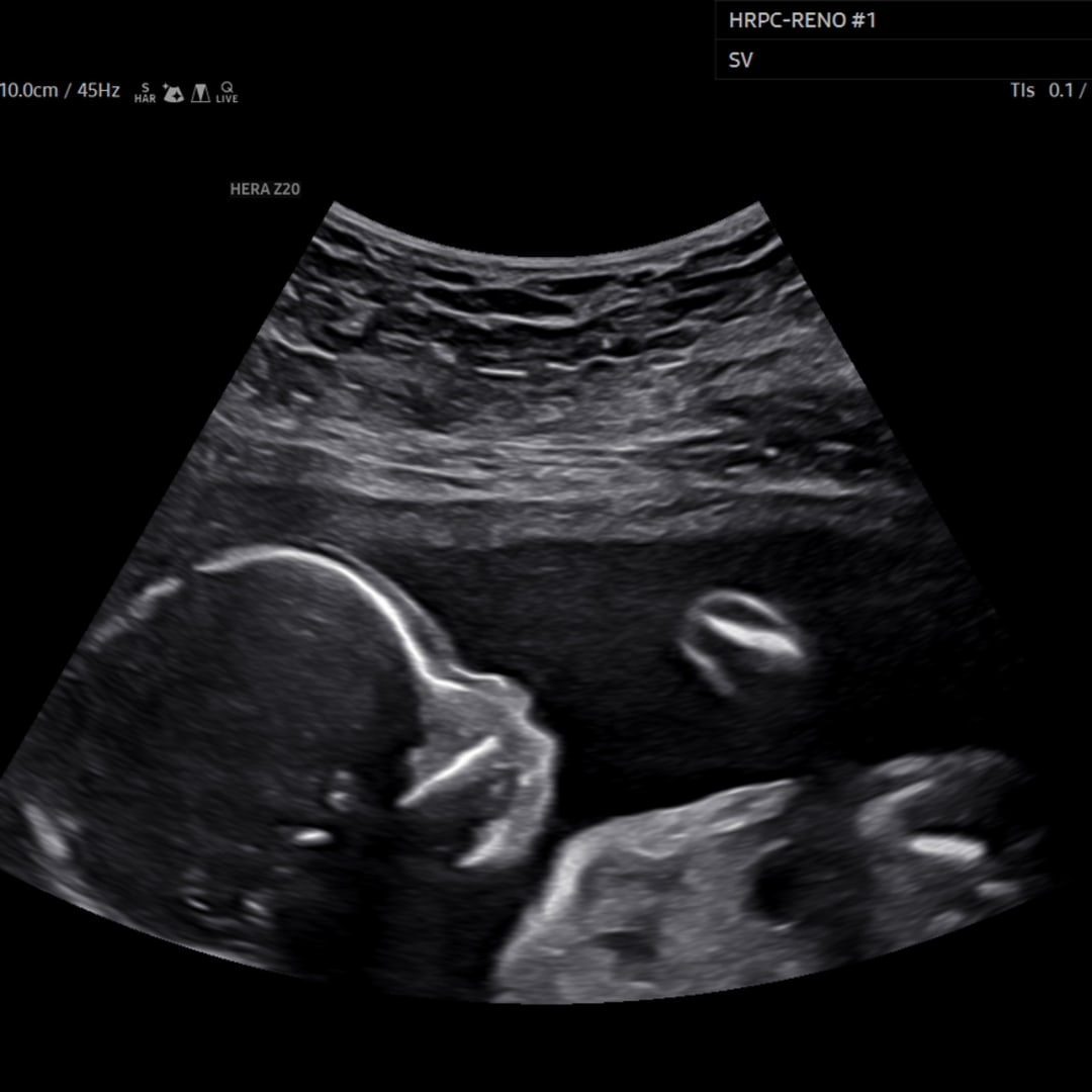 Photo shared by Bella for their Babylist baby registry.