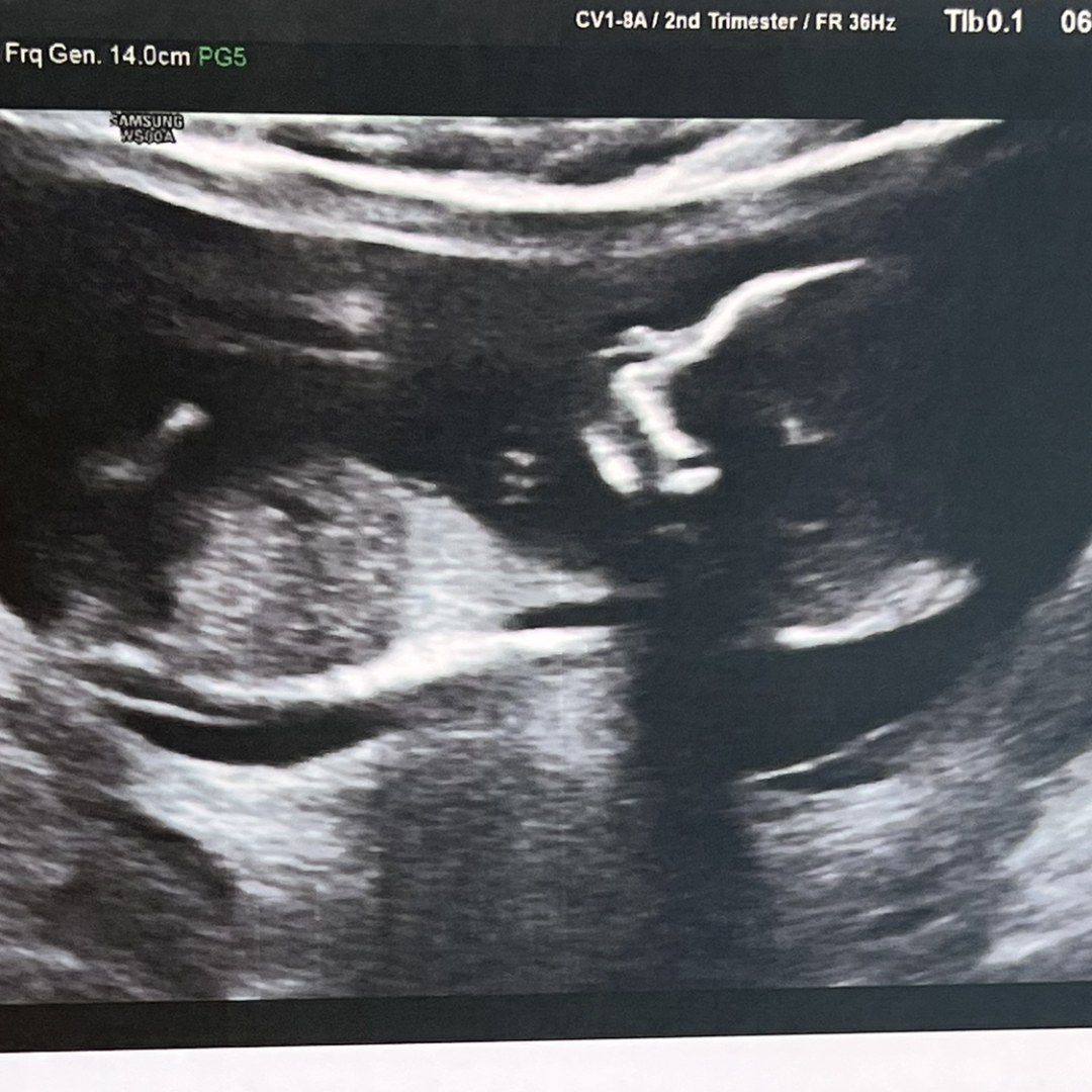Photo shared by Diana for their Babylist baby registry.