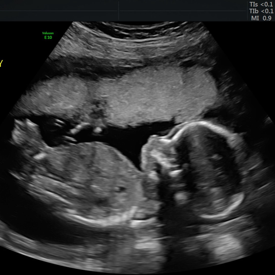 Photo shared by Eryn & Hunter for their Babylist baby registry.