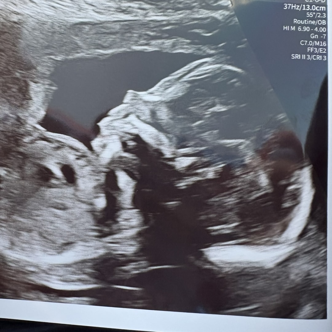 Photo shared by Haley for their Babylist baby registry.