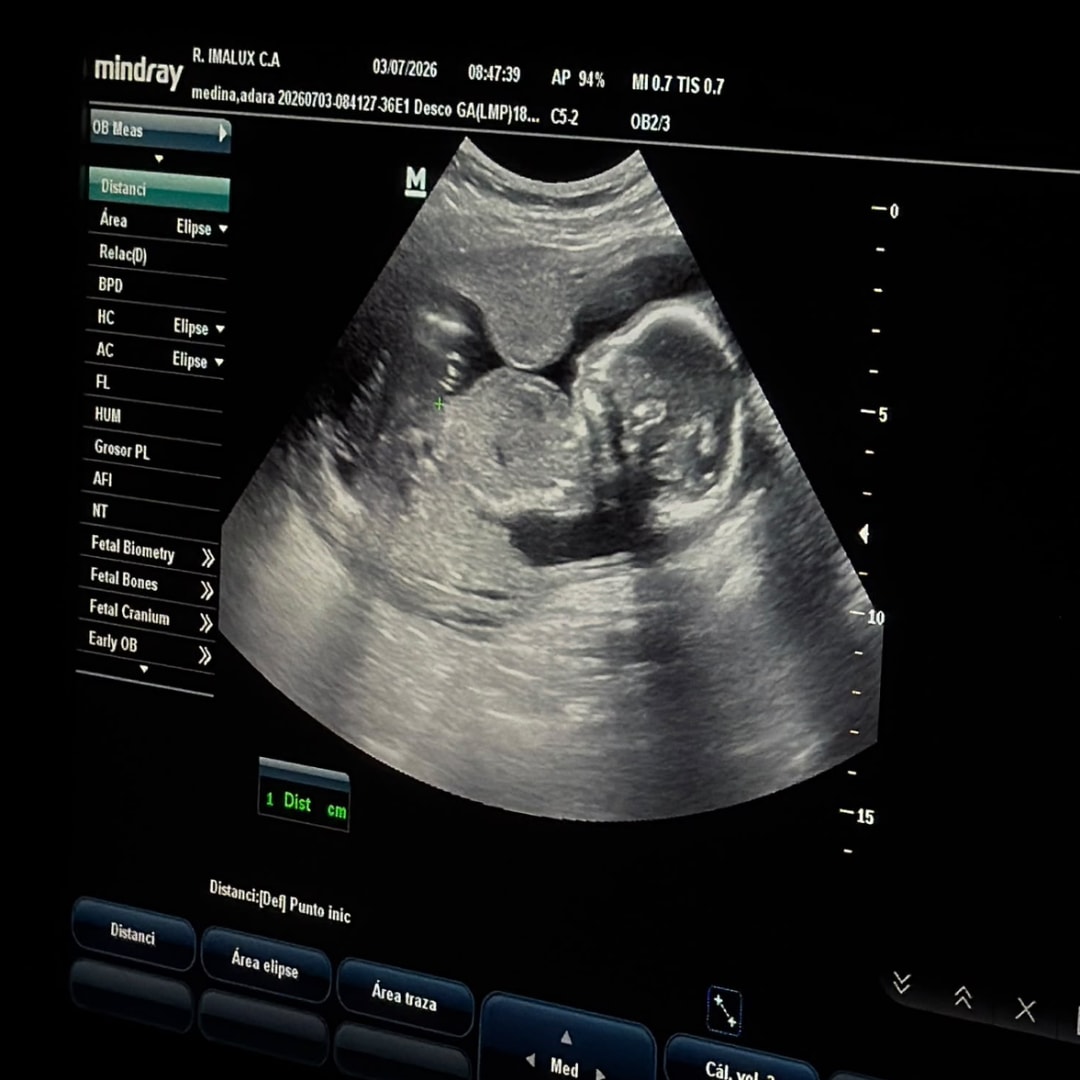 Photo shared by Adara for their Babylist baby registry.