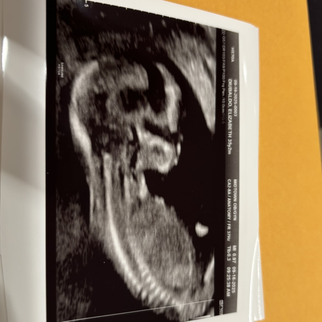 Photo shared by Liz for their Babylist baby registry.