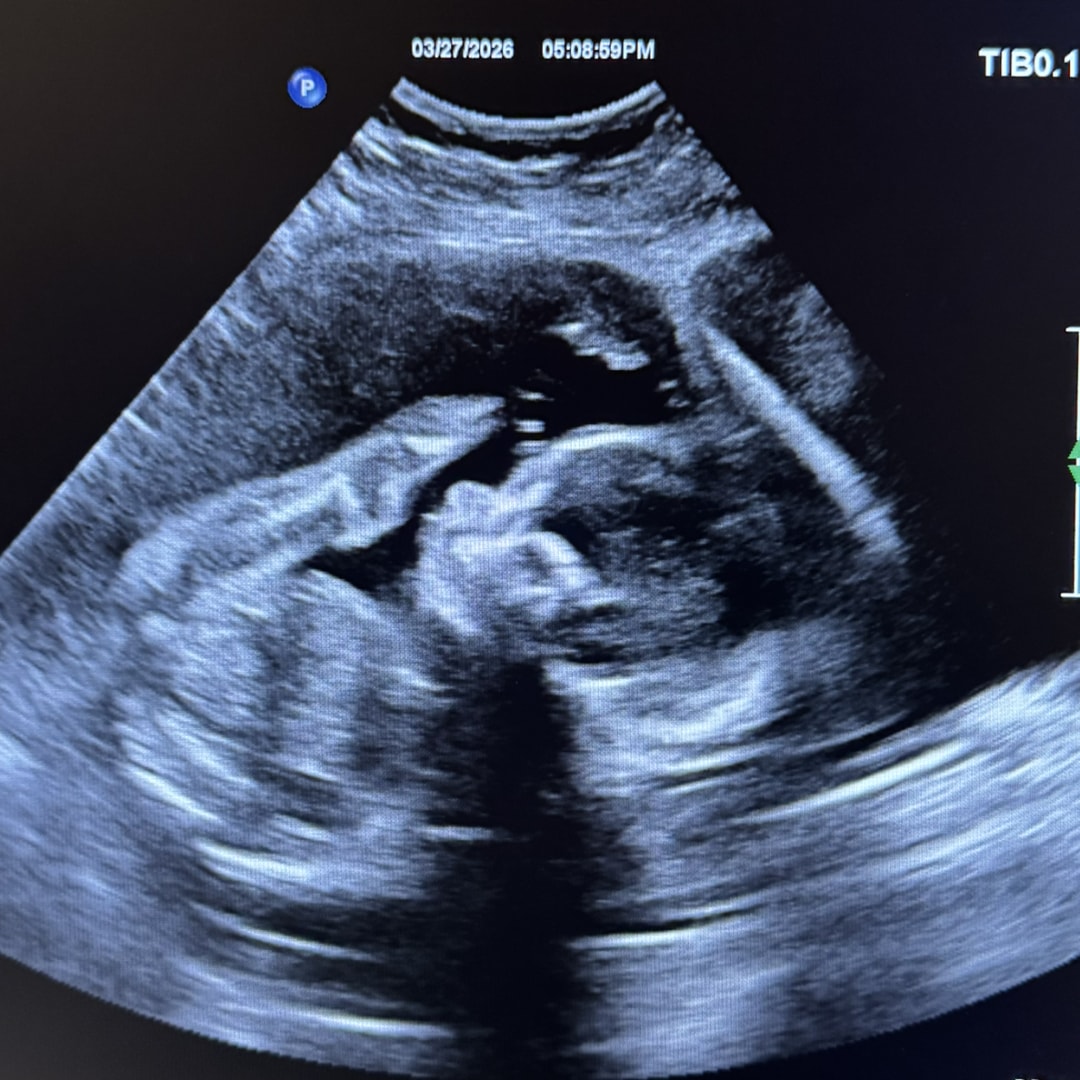 Photo shared by Hallie for their Babylist baby registry.